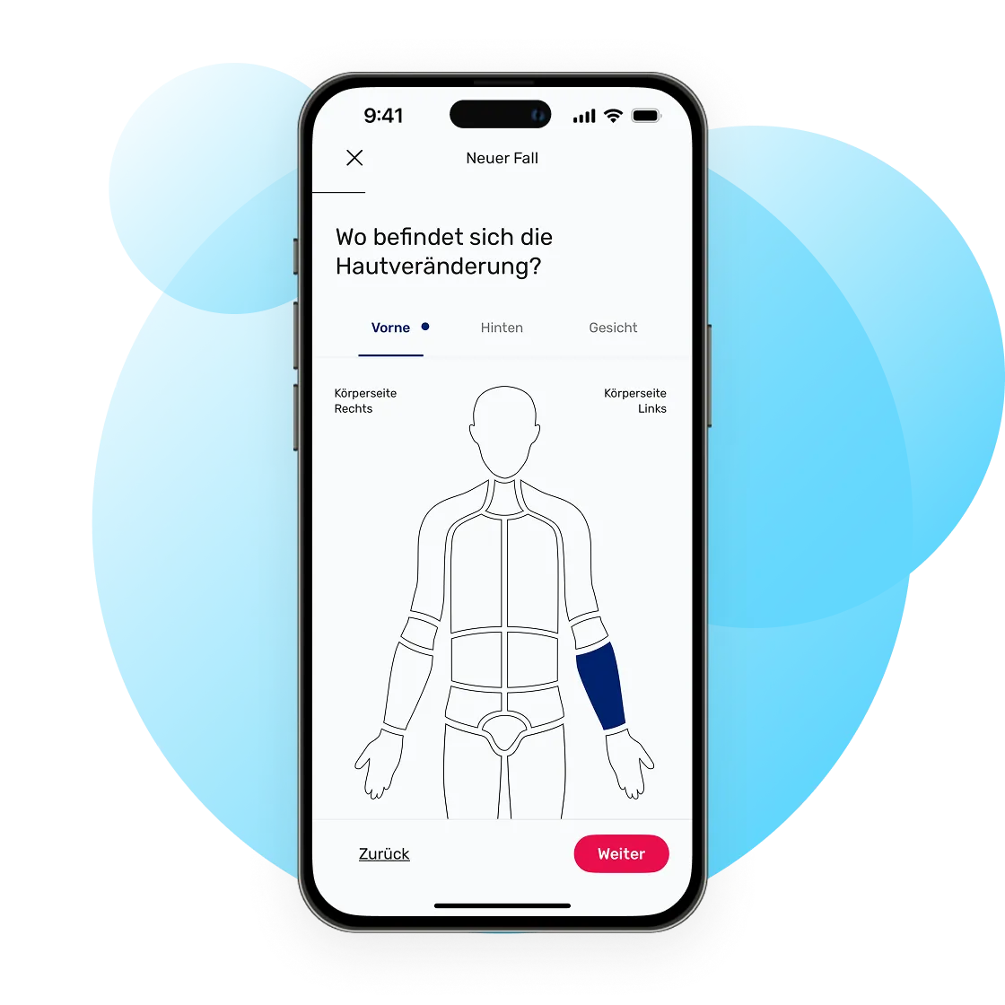 Die dermanostic Hautarzt App