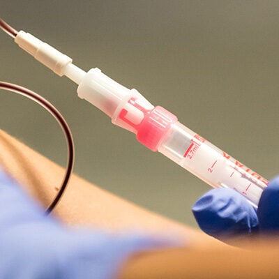 Die Diagnose für Diabetes Typ erfolgt über Blutabnahme.