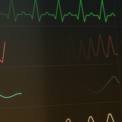 Das Herz-Kreislauf-System lässt sich auf verschiedene Arten überwachen
