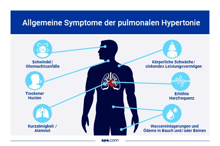Symptome einer pulmonalen Hypertonie