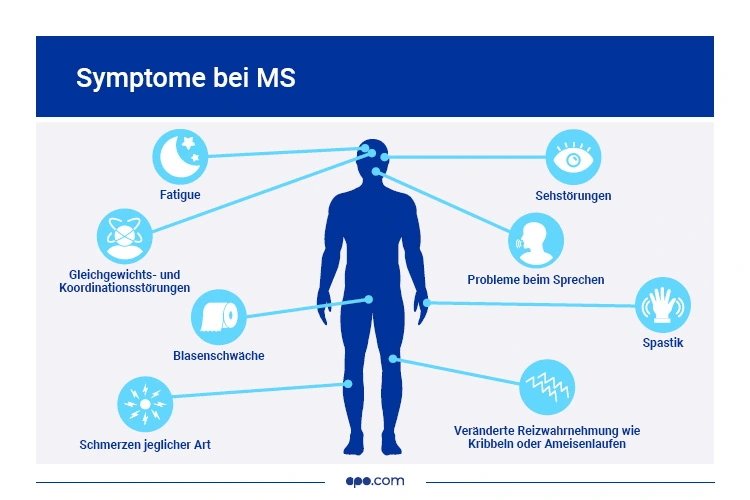 Plötzlich Multiple Sklerose-symptome Häufigste Beschwerden