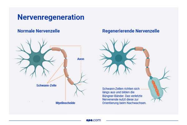 MD-51038_infografik_nervengeneration_apocom Gegenüberstellung einer normalen und einer regenerierenden Nervenzelle